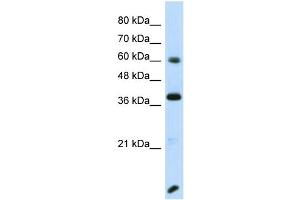Host:  Rabbit  Target Name:  RFX4  Sample Type:  Transfected 293T Whole Cell lysates  Antibody Dilution:  1.