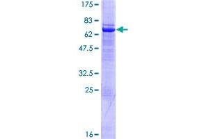 SETMAR Protein (AA 1-352) (GST tag)