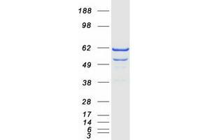 Validation with Western Blot (PANK2 Protein (Transcript Variant 1) (Myc-DYKDDDDK Tag))