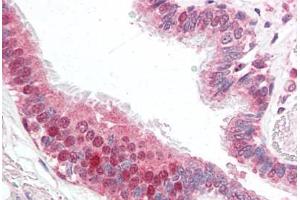 Human Lung (formalin-fixed, paraffin-embedded) stained with CFLAR antibody ABIN461877 at 5 ug/ml followed by biotinylated goat anti-rabbit IgG secondary antibody ABIN481713, alkaline phosphatase-streptavidin and chromogen. (FLIP antibody  (AA 191-209))