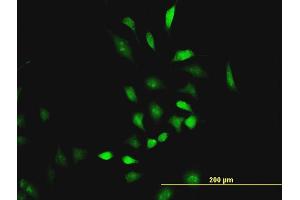 Immunofluorescence of monoclonal antibody to CBS on HeLa cell. (CBS antibody  (AA 1-100))