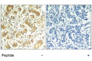 Image no. 1 for anti-Spleen tyrosine Kinase (SYK) (AA 321-325) antibody (ABIN319416) (SYK antibody  (AA 321-325))