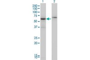 Western Blot analysis of CSTF2 expression in transfected 293T cell line by CSTF2 monoclonal antibody (M01), clone 3D1-3A6. (CSTF2 antibody  (AA 1-577))