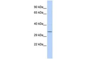 Image no. 1 for anti-NmrA-Like Family Domain Containing 1 (NMRAL1) (AA 216-265) antibody (ABIN6741458) (NMRAL1 antibody  (AA 216-265))