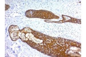 Formalin paraffin human skin stained with Basic Cytokeratin antibody (KRTH/1076).