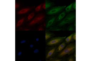 ABIN6260576 and ABIN6276962 staining  cells by IF/ICC.