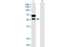 Western Blot analysis of CHD2 expression in transfected 293T cell line by CHD2 MaxPab polyclonal antibody. (CHD2 antibody  (AA 1-501))