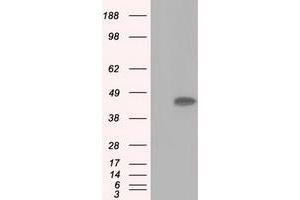 Image no. 7 for anti-Acetyl-CoA Acetyltransferase 2 (ACAT2) antibody (ABIN1496400) (ACAT2 antibody)