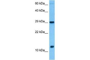 Host:  Rabbit  Target Name:  MRPS6  Sample Tissue:  Human Testicular Tumor lysates  Antibody Dilution:  1ug/ml (MRPS6 antibody  (C-Term))