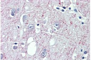 Brain, cortex, Human: Formalin-Fixed, Paraffin-Embedded (FFPE) (GABBR1 antibody  (AA 947-961))