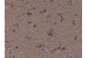 Detection of PAK1 in Human Brain Tissue using Polyclonal Antibody to p21 Protein Activated Kinase 1 (PAK1) (PAK1 antibody  (AA 252-501))