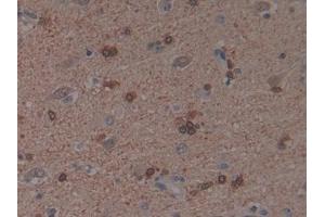 Detection of PAK1 in Human Brain Tissue using Polyclonal Antibody to p21 Protein Activated Kinase 1 (PAK1)