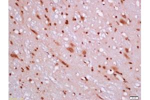 Formalin-fixed and paraffin embedded rat brain labeled with Rabbit Anti-BCL2L1 Polyclonal Antibody, Unconjugated 1:200 followed by conjugation to the secondary antibody and DAB staining