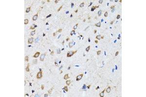 Immunohistochemistry of paraffin-embedded rat brain using NDE1 antibody. (NDE1 antibody  (AA 1-110))