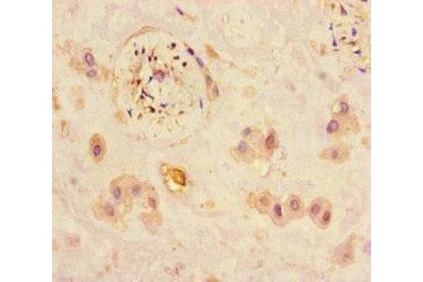 JARID2 antibody  (AA 1-159)