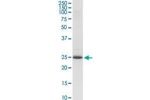 ARHGDIA MaxPab rabbit polyclonal antibody. (ARHGDIA antibody  (AA 1-204))