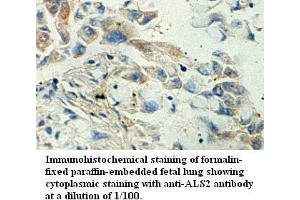 Image no. 1 for anti-Amyotrophic Lateral Sclerosis 2 (Juvenile) (ALS2) antibody (ABIN1574645) (ALS2 antibody)