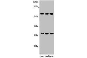 Western blot All lanes: MAOB antibody at 9 μg/mL Lane 1: Mouse liver tissue Lane 2: HepG2 whole cell lysate Lane 3: A549 whole cell lysate Secondary Goat polyclonal to rabbit IgG at 1/10000 dilution Predicted band size: 59, 47 kDa Observed band size: 59, 27 kDa (Monoamine Oxidase B antibody  (AA 2-489))