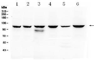 Western Blotting (WB) image for anti-Phosphoinositide-3-Kinase, Catalytic, beta Polypeptide (PIK3CB) (AA 556-598), (Middle Region) antibody (ABIN5518862)