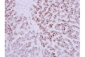 IHC-P Image Immunohistochemical analysis of paraffin-embedded human breast cancer, using EDIL3, antibody at 1:250 dilution.