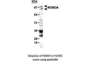 Image no. 1 for anti-Roundabout, Axon Guidance Receptor, Homolog 4 (ROBO4) (AA 900-1007), (C-Term) antibody (ABIN363598) (ROBO4 antibody  (C-Term))