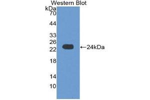 Western Blotting (WB) image for anti-Crystallin, alpha B (CRYAB) (AA 1-175) antibody (ABIN1867399) (CRYAB antibody  (AA 1-175))