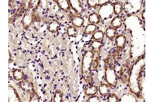 Paraformaldehyde-fixed, paraffin embedded rat kidney, Antigen retrieval by boiling in sodium citrate buffer (pH6) for 15min, Block endogenous peroxidase by 3% hydrogen peroxide for 30 minutes,  Blocking buffer (normal goat serum) at 37°C for 20min, Antibody incubation with HDAC6 Polyclonal Antibody (bs-2811R) at 1:400 overnight at 4°C, followed by a conjugated secondary and DAB staining. (HDAC6 antibody  (AA 301-400))