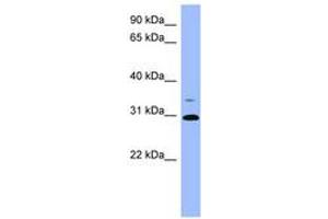 Image no. 1 for anti-Phosphoserine Phosphatase (PSPH) (AA 71-120) antibody (ABIN6741801)