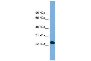 BCL7A antibody used at 1 ug/ml to detect target protein. (BCL7A antibody  (Middle Region))