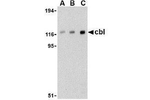 Western blot analysis of cbl in Daudi cell lysate with AP30209PU-N cbl antibody at (A) 0.
