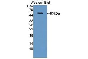 Detection of Recombinant LRG1, Mouse using Polyclonal Antibody to Leucine Rich Alpha-2-Glycoprotein 1 (LRG1) (LRG1 antibody  (AA 136-342))