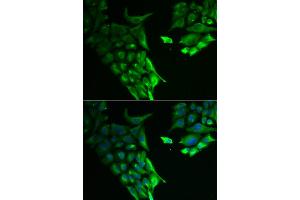 Immunofluorescence analysis of A549 cells using HABP2 antibody. (HABP2 antibody)