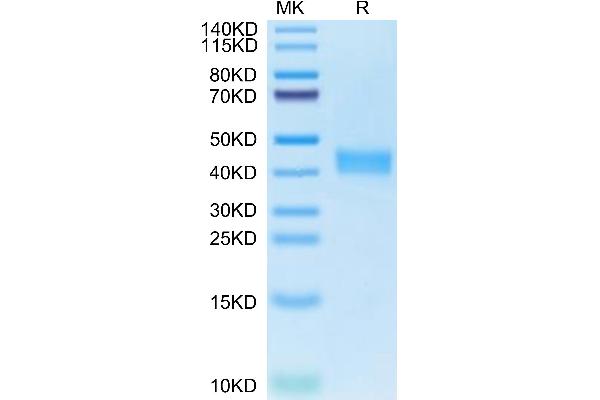 CA12 Protein (AA 25-301) (His tag)