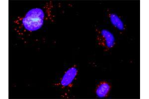 Proximity Ligation Analysis of protein-protein interactions between GSTP1 and MAPK8. (GSTP1 antibody  (AA 1-210))