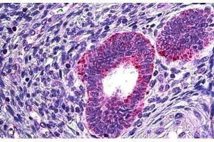 Human Uterus: Formalin-Fixed, Paraffin-Embedded (FFPE) (PLA2G4A antibody  (AA 153-166))