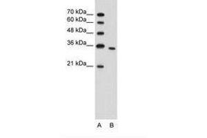 Image no. 1 for anti-phosphoribosyl Pyrophosphate Synthetase 2 (PRPS2) (N-Term) antibody (ABIN203391) (PRPS2 antibody  (N-Term))