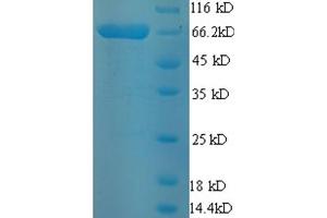 SDS-PAGE (SDS) image for Electron-Transferring-Flavoprotein Dehydrogenase (ETFDH) (AA 34-617) protein (His-SUMO Tag) (ABIN5709485)