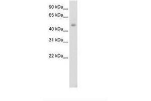 Image no. 1 for anti-Jumonji Domain Containing 6 (JMJD6) (AA 296-345) antibody (ABIN202365) (JMJD6 antibody  (AA 296-345))
