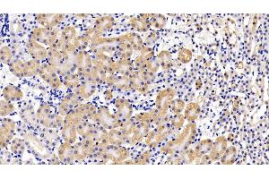 Detection of LIFR in Mouse Kidney Tissue using Polyclonal Antibody to Leukemia Inhibitory Factor Receptor (LIFR) (LIFR antibody  (AA 151-290))