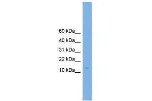 WB Suggested Anti-CPLX2 Antibody Titration: 0. (CPLX2 antibody  (N-Term))