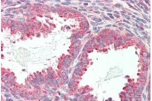 Human Uterus: Formalin-Fixed, Paraffin-Embedded (FFPE) (TMPRSS3 antibody  (AA 420-460))