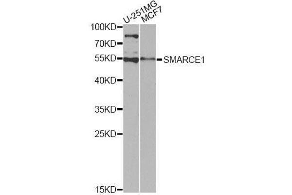 SMARCE1 抗体  (AA 1-411)