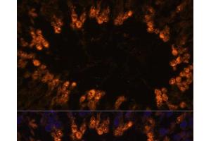 Immunofluorescence analysis of Rat testis using OXCT2 Polyclonal Antibody at dilution of 1:100. (OXCT2 antibody)