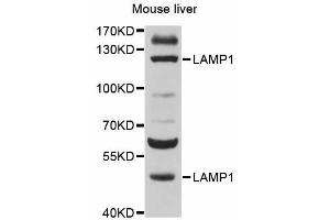Western blot analysis of extracts of mouse liver, using LAMP1 antibody (ABIN5998110) at 1/500 dilution. (LAMP1 antibody)