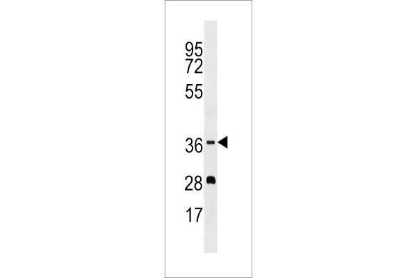 OR5M1 antibody  (C-Term)