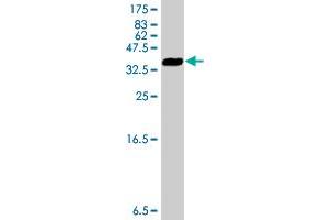 Western Blot detection against Immunogen (34. (GLIPR1 antibody  (AA 23-99))