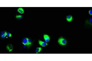 Immunofluorescence staining of MCF-7 cells with ABIN7151731 at 1:133, counter-stained with DAPI. (ECSCR antibody  (AA 25-124))