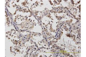 Immunostaining (ISt) image for anti-Actinin, alpha 4 (ACTN4) (AA 592-701) antibody (ABIN559759)