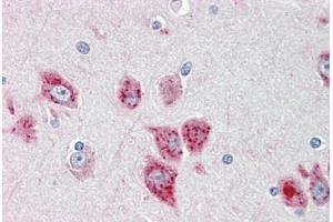 Human Brain, Cortex: Formalin-Fixed, Paraffin-Embedded (FFPE) (ANKH antibody  (AA 464-492))