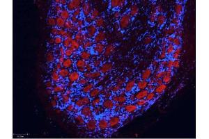 Immunofluorescence (IF) image for Rabbit anti-Mouse IgG antibody (Atto 550) - Preadsorbed (ABIN1043988) (Rabbit anti-Mouse IgG Antibody (Atto 550) - Preadsorbed)